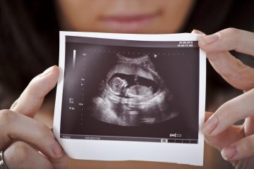 El aborto está prohibido en la autonomía norirlandesa excepto en casos de riesgo extremo para la madre, por lo que muchas mujeres de la provincia se desplazan para interrumpir su embarazo a otras partes del Reino Unido, donde la ley es más flexible.
(Dreamstime)