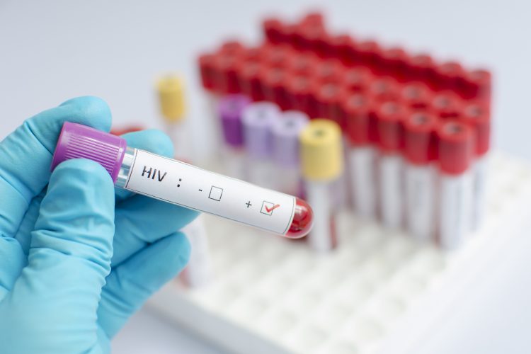 Los tratamientos antirretrovíricos, recomendados actualmente para las infecciones por VIH, "suprimen la réplica del virus y evita la progresión de la enfermedad" en el cuerpo, señalan los autores del estudio.
(Dreamstime)