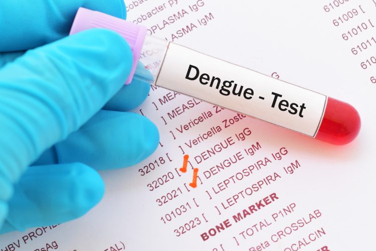 El dengue es la enfermedad infecciosa de más rápida expansión en el mundo, con medio millón de infecciones potencialmente mortales de media al año y unas 20.000 muertes, en su mayoría niños.
(Dreamstime)